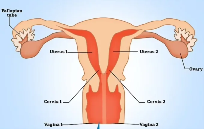 Две вагины и матки у женщин -не редкость
